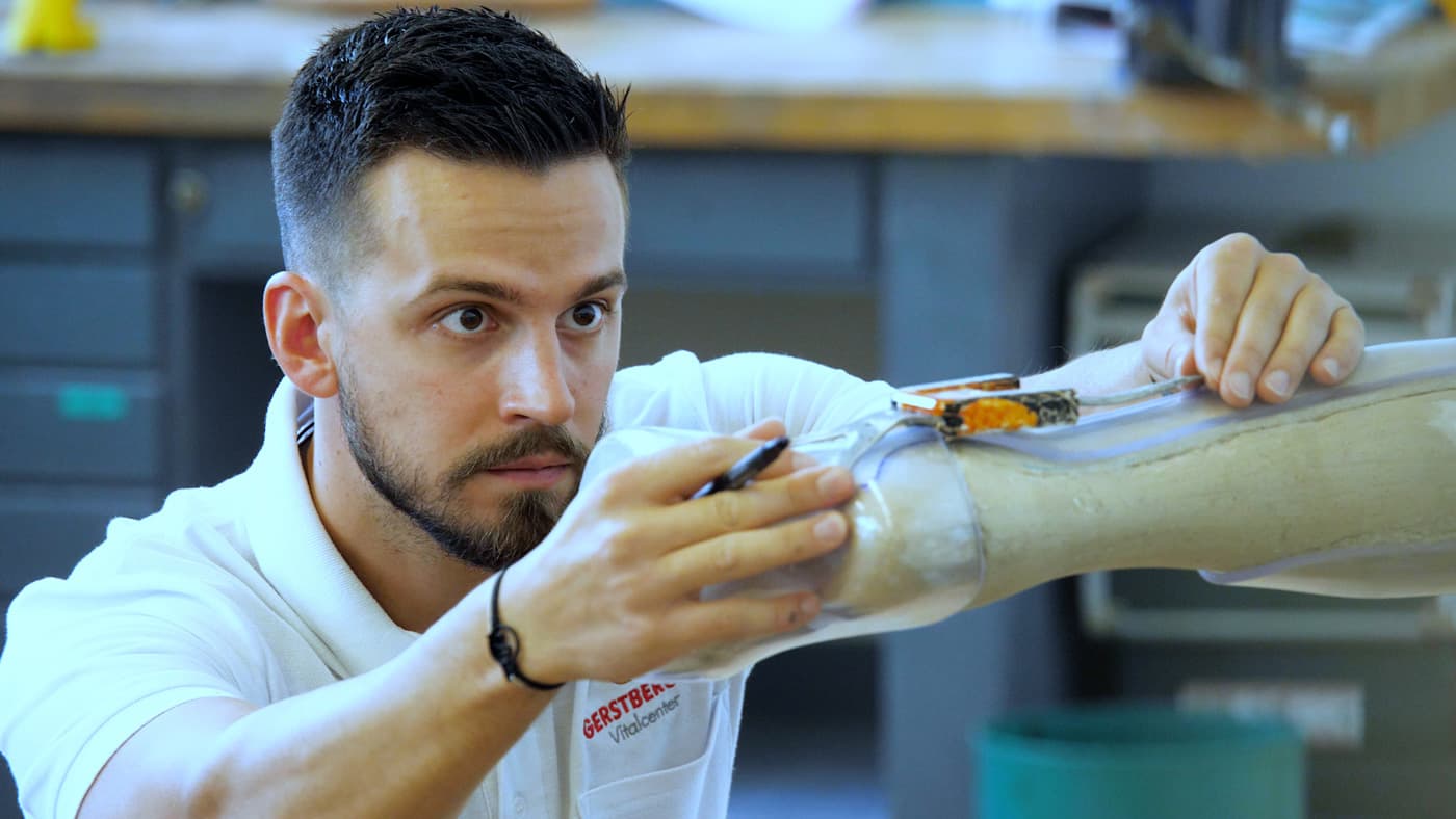 Orthopädiemechaniker misst ein Gipsbein aus